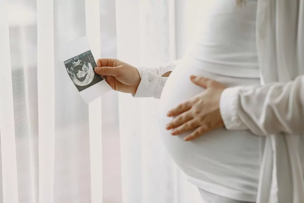 Pregnant Woman Standing By Window Looking Photo Min 1 1024x683.Jpg